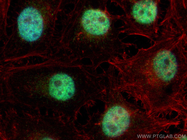 EHMT1 Antibody in Immunocytochemistry (ICC/IF)