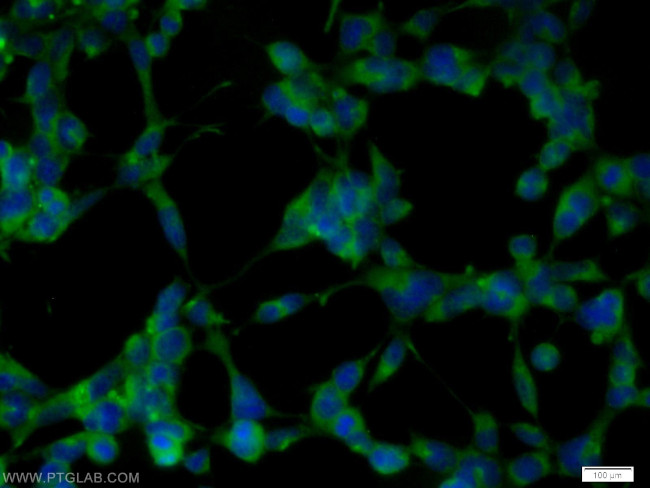 EXOC6B Antibody in Immunocytochemistry (ICC/IF)