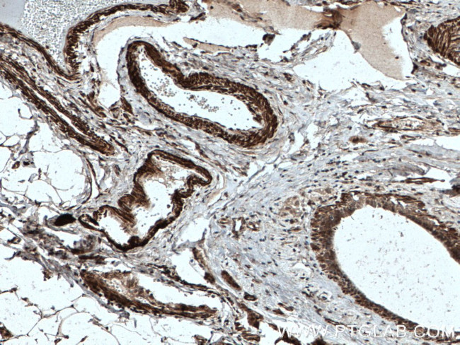 TPM2 Antibody in Immunohistochemistry (Paraffin) (IHC (P))