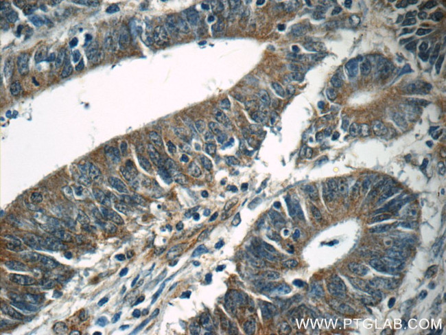 TPM3 Antibody in Immunohistochemistry (Paraffin) (IHC (P))