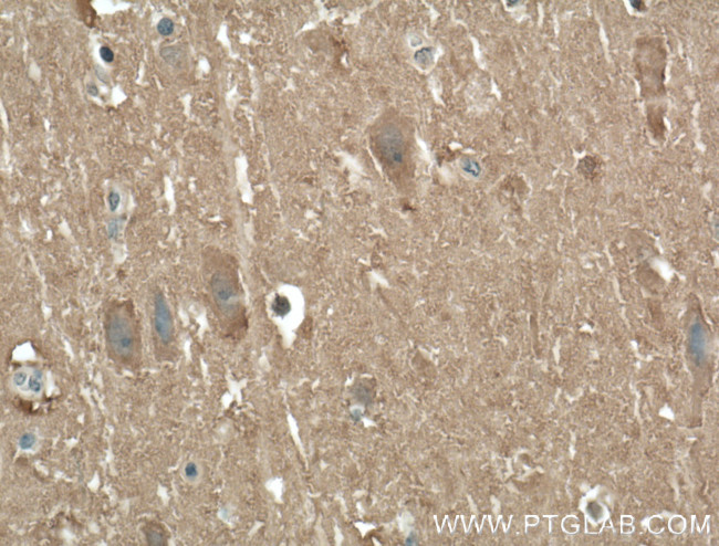 AHSA2 Antibody in Immunohistochemistry (Paraffin) (IHC (P))