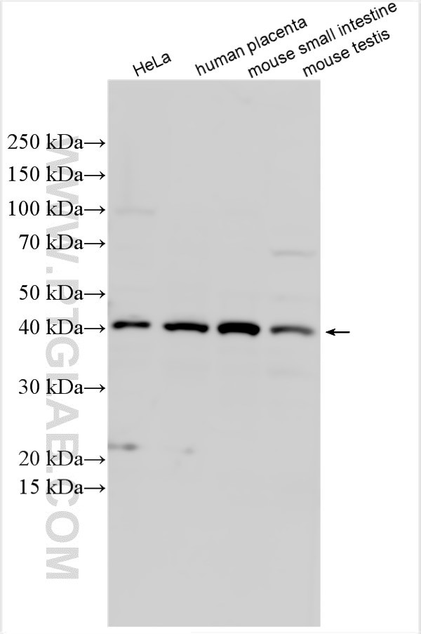 B4GALT1 Antibody in Western Blot (WB)