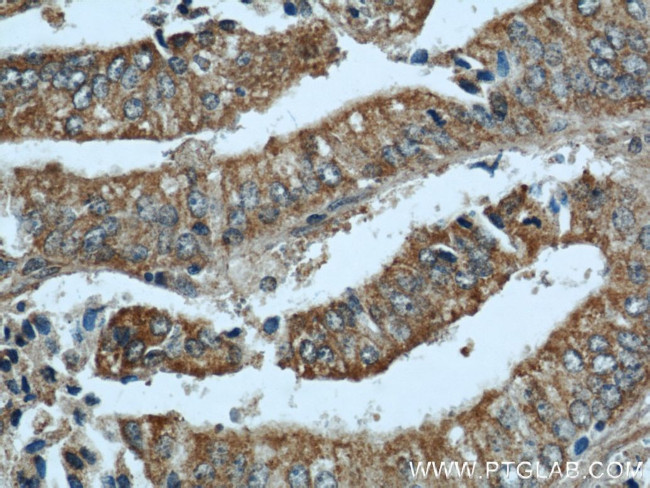 NOV Antibody in Immunohistochemistry (Paraffin) (IHC (P))
