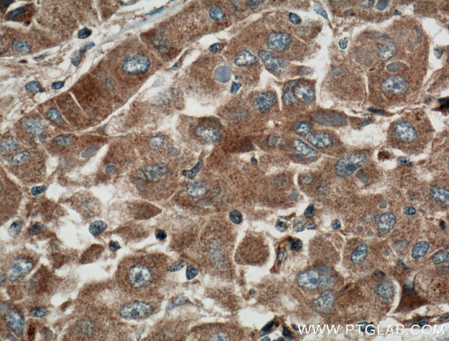 Cyp2c7 Antibody in Immunohistochemistry (Paraffin) (IHC (P))