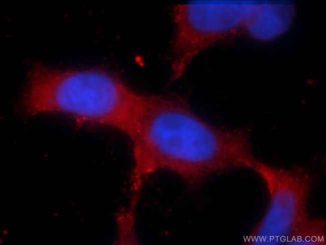 TRPM6 Antibody in Immunocytochemistry (ICC/IF)