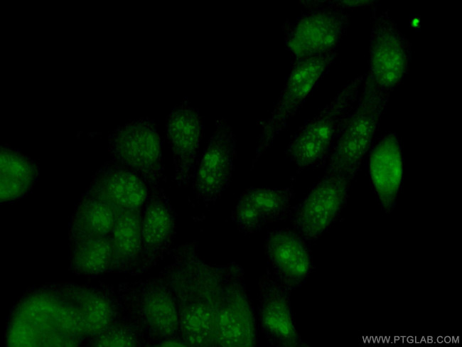 UBE2E1 Antibody in Immunocytochemistry (ICC/IF)