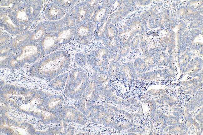 Phospholipase C epsilon 1 Antibody in Immunohistochemistry (Paraffin) (IHC (P))