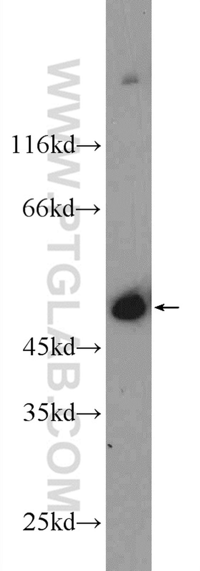MURC Antibody in Western Blot (WB)