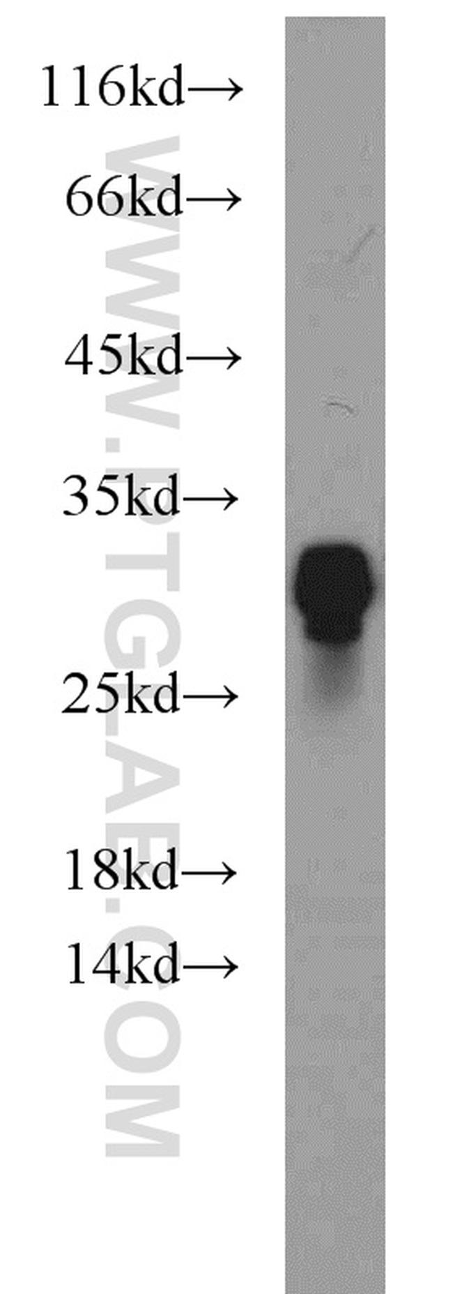 NPAS3 Antibody in Western Blot (WB)