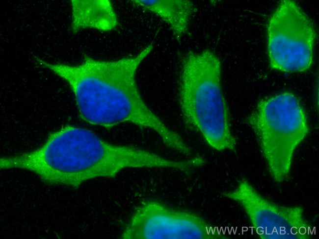 GSTM2 Antibody in Immunocytochemistry (ICC/IF)