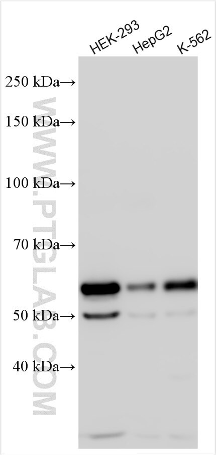 CCBL2 Antibody in Western Blot (WB)