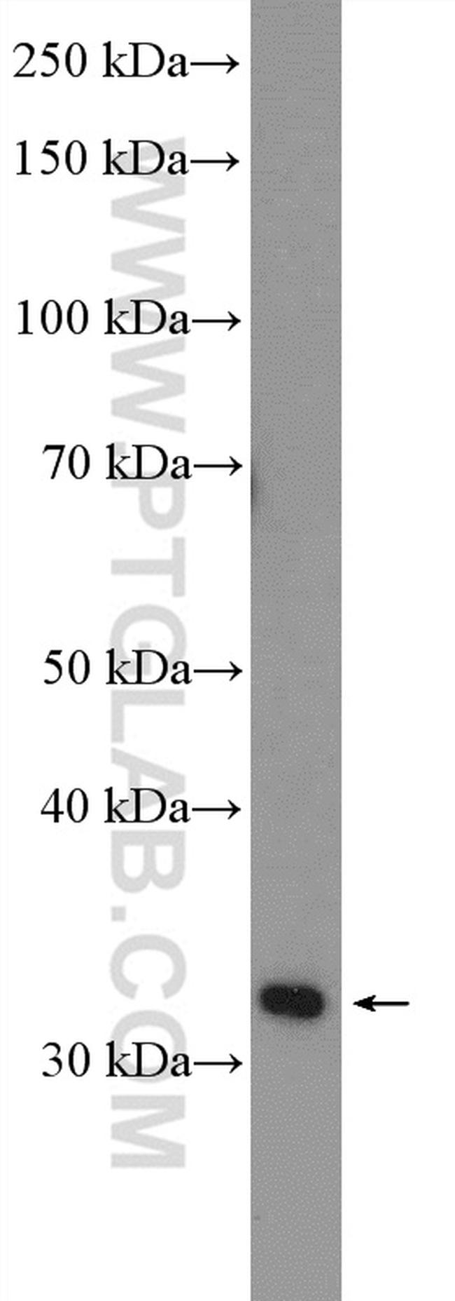 LRRC38 Antibody in Western Blot (WB)