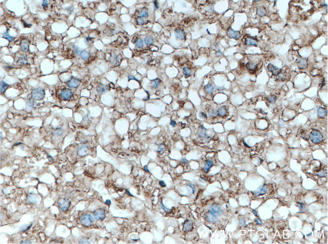 Serpina3k Antibody in Immunohistochemistry (Paraffin) (IHC (P))