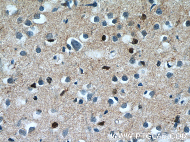 NKX1-2 Antibody in Immunohistochemistry (Paraffin) (IHC (P))
