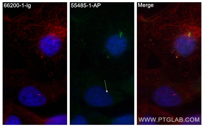 Rootletin Antibody in Immunocytochemistry (ICC/IF)