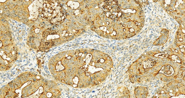 MUC13 Antibody in Immunohistochemistry (Paraffin) (IHC (P))