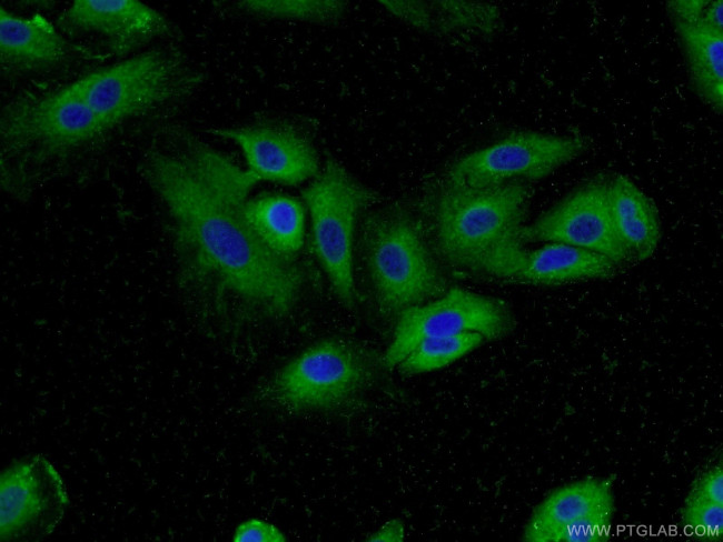 MUC8 Antibody in Immunocytochemistry (ICC/IF)
