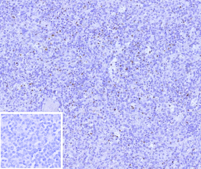 Perforin-1 (Pore Forming Protein) (Apoptosis Marker) Antibody in Immunohistochemistry (Paraffin) (IHC (P))