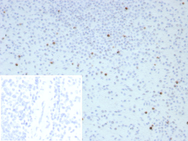 Perforin-1 (Pore Forming Protein) (Apoptosis Marker) Antibody in Immunohistochemistry (Paraffin) (IHC (P))