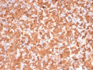 Protein Kinase C iota/lambda/PRKCI Antibody in Immunohistochemistry (Paraffin) (IHC (P))