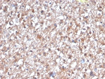 Protein Kinase C iota/lambda/PRKCI Antibody in Immunohistochemistry (Paraffin) (IHC (P))