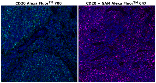 CD20 Antibody in Immunohistochemistry (Paraffin) (IHC (P))