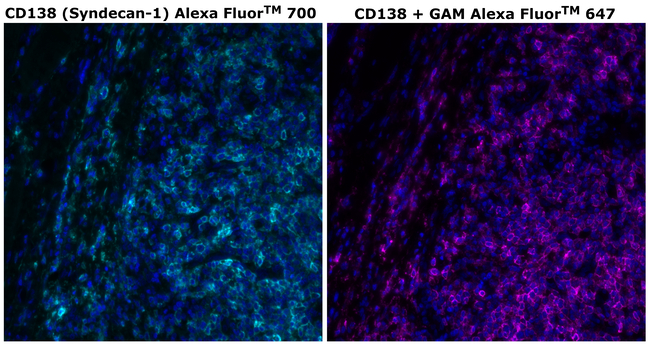CD138 Antibody in Immunohistochemistry (Paraffin) (IHC (P))