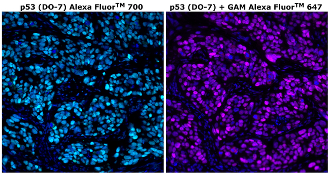 p53 Antibody in Immunohistochemistry (Paraffin) (IHC (P))
