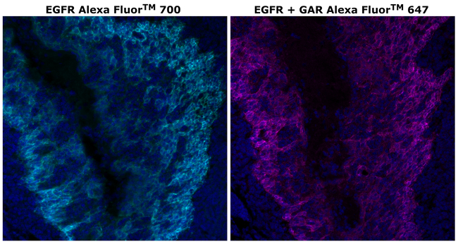 EGFR Antibody in Immunohistochemistry (Paraffin) (IHC (P))