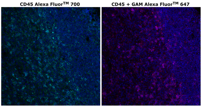 CD45 Antibody in Immunohistochemistry (Paraffin) (IHC (P))