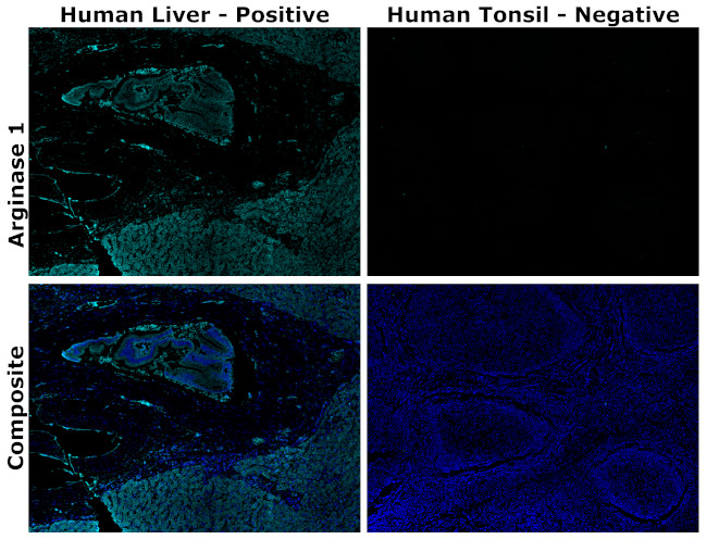 Arginase 1 Antibody in Immunohistochemistry (Paraffin) (IHC (P))