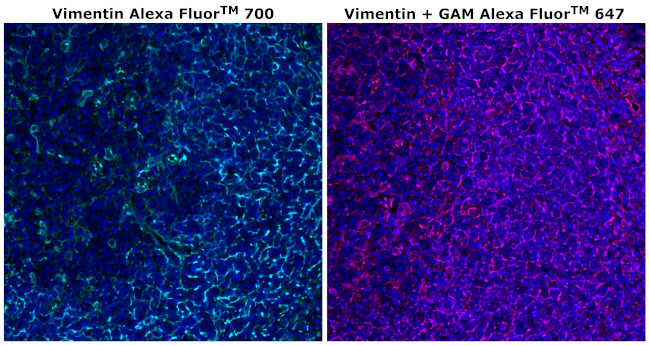 Vimentin Antibody in Immunohistochemistry (Paraffin) (IHC (P))