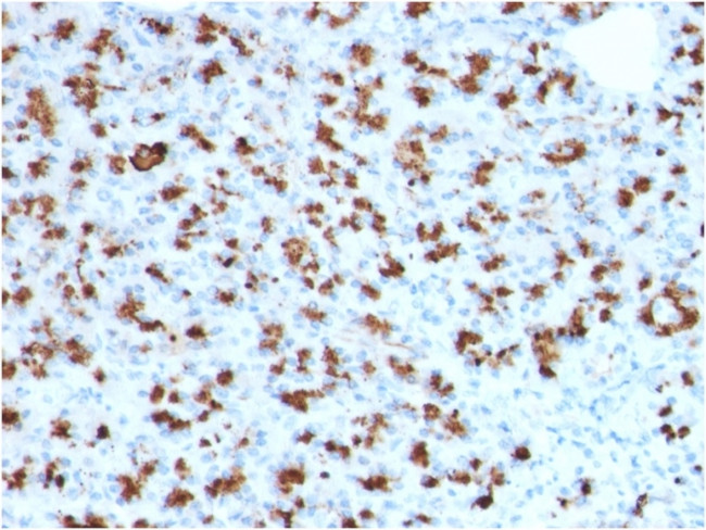 BARX1 (Prognostic Biomarker in Hepatocellular Carcinoma) Antibody in Immunohistochemistry (Paraffin) (IHC (P))