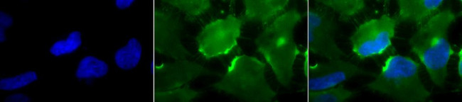 CD74 Antibody in Immunocytochemistry (ICC/IF)