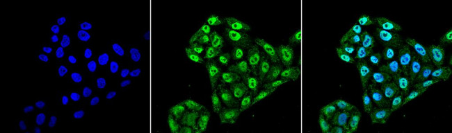 EndoPDI Antibody in Immunocytochemistry (ICC/IF)