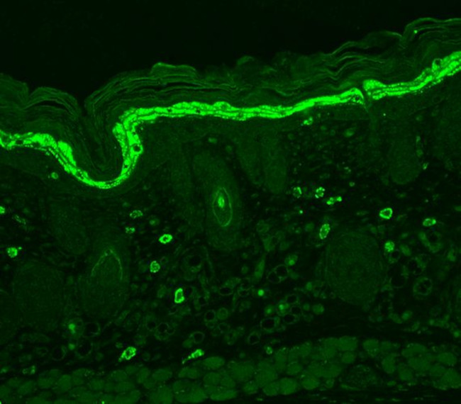 Phosphotyrosine Antibody in Immunohistochemistry (Paraffin) (IHC (P))