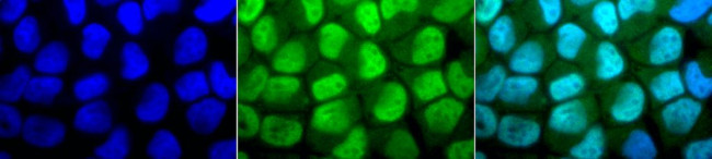 Methylated Lysine Antibody in Immunocytochemistry (ICC/IF)