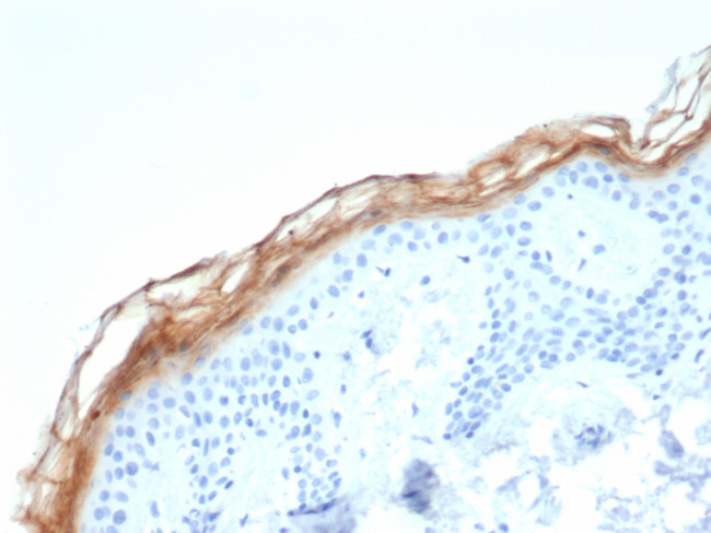 KLK7 (Kallikrein Related Peptidase 7) Antibody in Immunohistochemistry (Paraffin) (IHC (P))