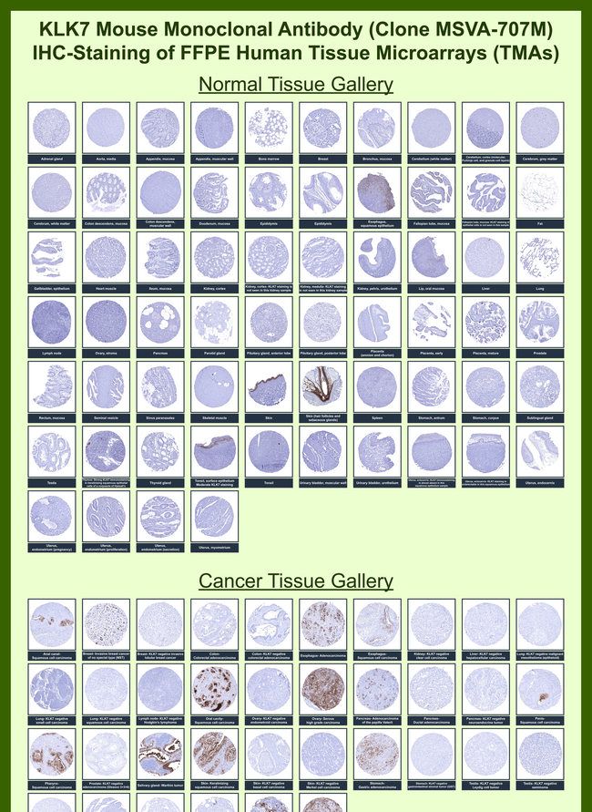 KLK7 (Kallikrein Related Peptidase 7) Antibody in Immunohistochemistry (Paraffin) (IHC (P))