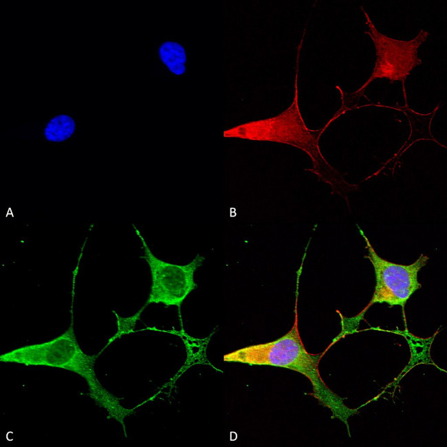Ankyrin-B Antibody in Immunocytochemistry (ICC/IF)