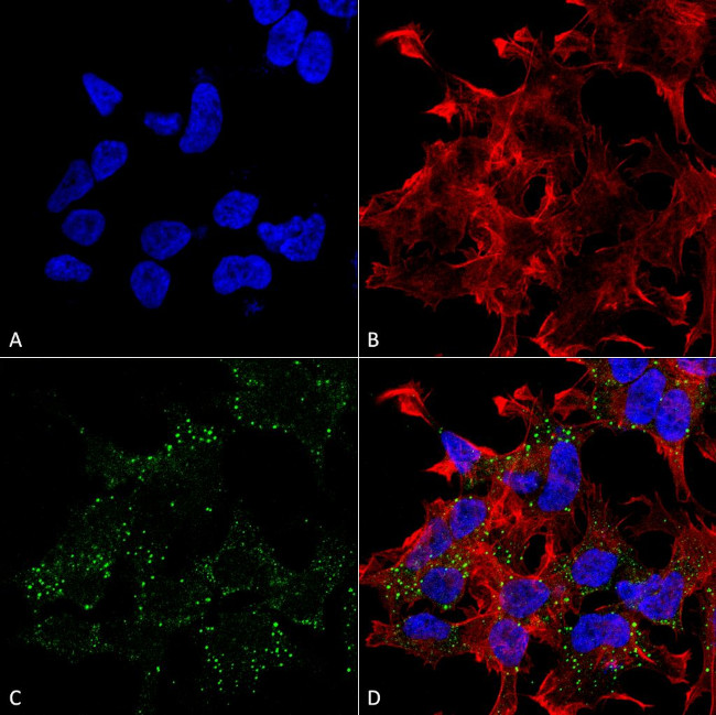 VGlut3 Transporter Antibody in Immunocytochemistry (ICC/IF)