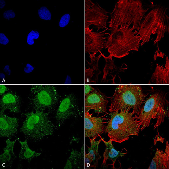 mGluR1/5 Glutamate Receptor Antibody in Immunocytochemistry (ICC/IF)