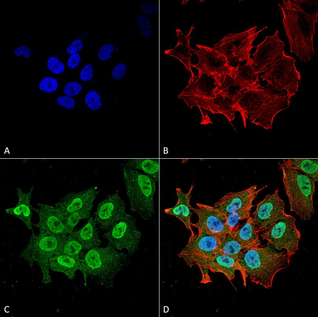 Ataxin-1 Antibody in Immunocytochemistry (ICC/IF)
