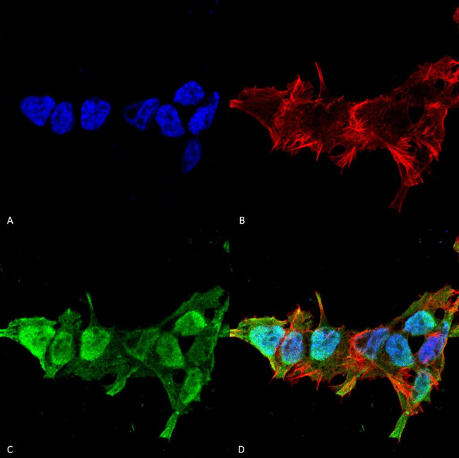 Mitofusin-2 Antibody in Immunocytochemistry (ICC/IF)