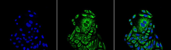 Beta-Actin Antibody in Immunocytochemistry (ICC/IF)