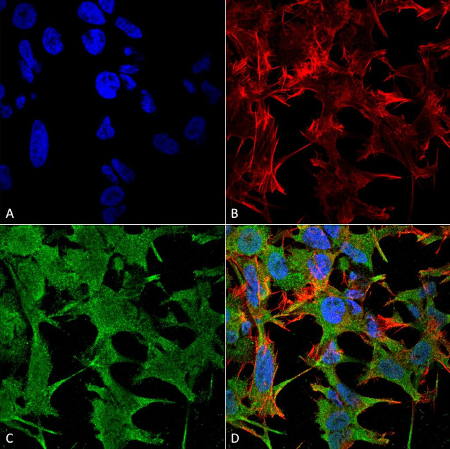 Neuronal Cell Adhesion Molecule (NRCAM) Antibody in Immunocytochemistry (ICC/IF)