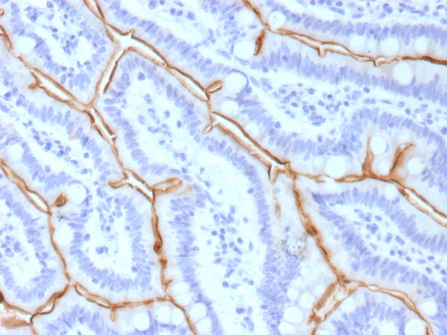 MUC13/Mucin 13 Antibody in Immunohistochemistry (Paraffin) (IHC (P))