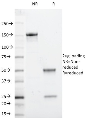 Beta-2 Microglobulin (Renal Failure and Tumor Marker) Antibody in SDS-PAGE (SDS-PAGE)