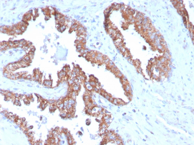 PMEPA1/TMEPAI (Tumor Suppressor Oncoprotein) Antibody in Immunohistochemistry (Paraffin) (IHC (P))