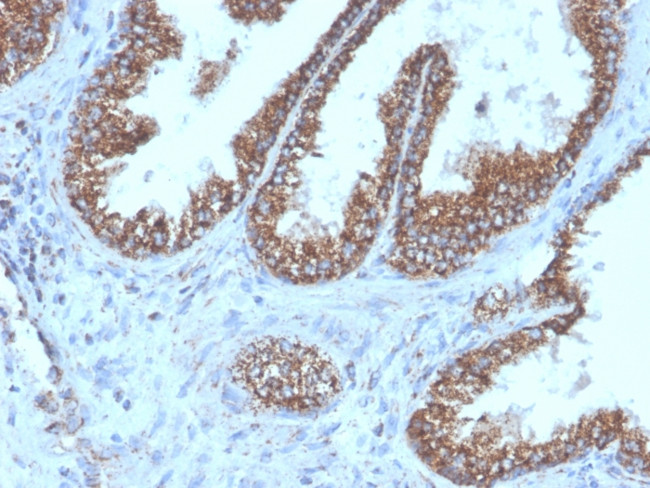 PMEPA1/TMEPAI (Tumor Suppressor Oncoprotein) Antibody in Immunohistochemistry (Paraffin) (IHC (P))